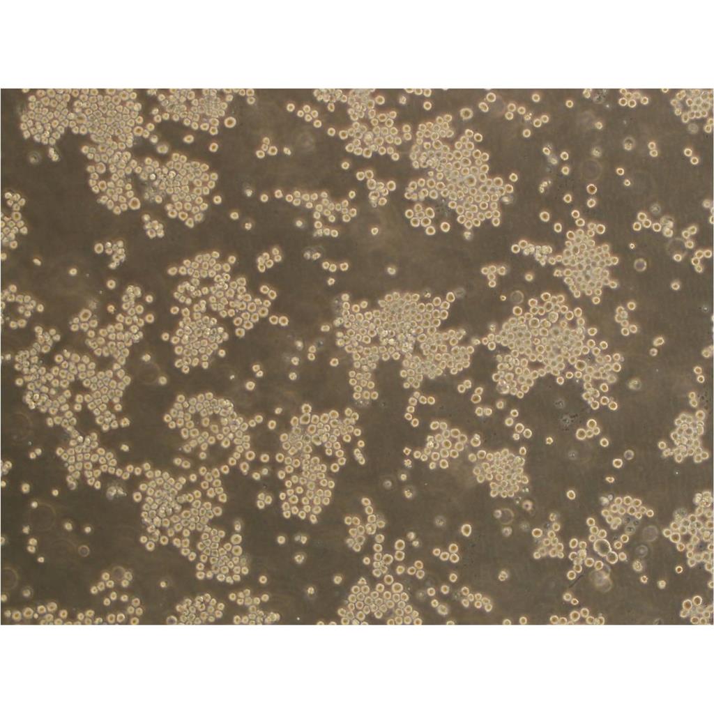 Tu 212 Cells人喉癌细胞长期复苏|带STR图谱