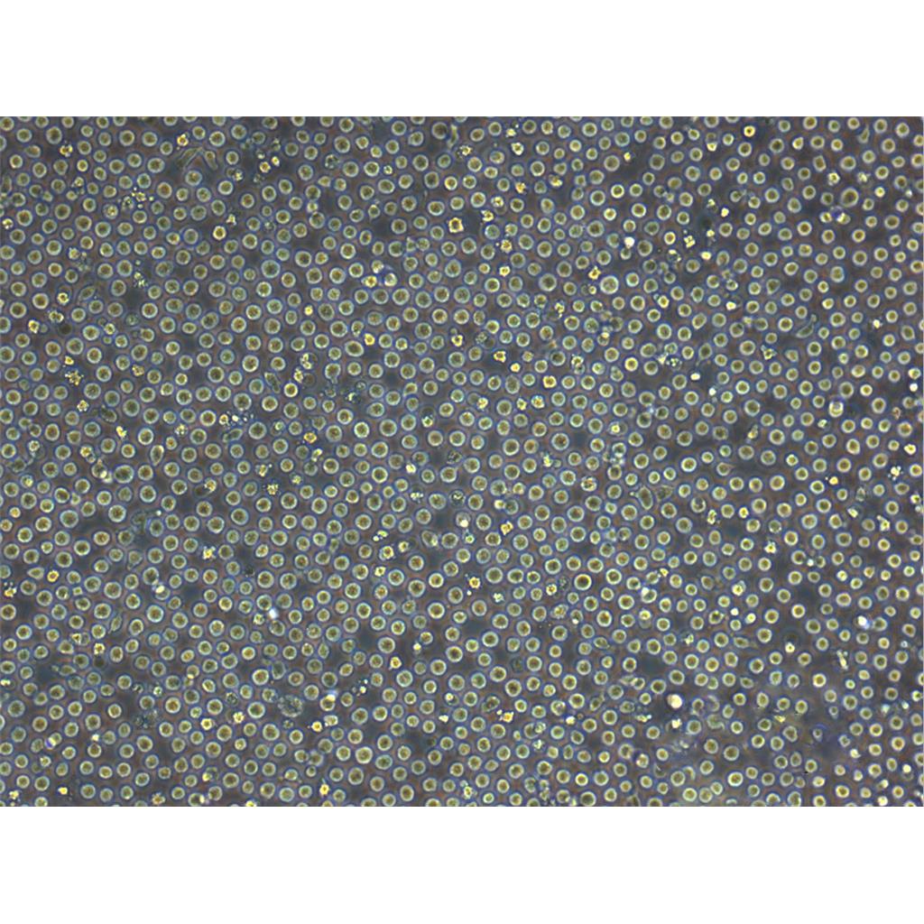 SU-DHL-6 Cells人B淋巴瘤细胞批次新|送STR图谱