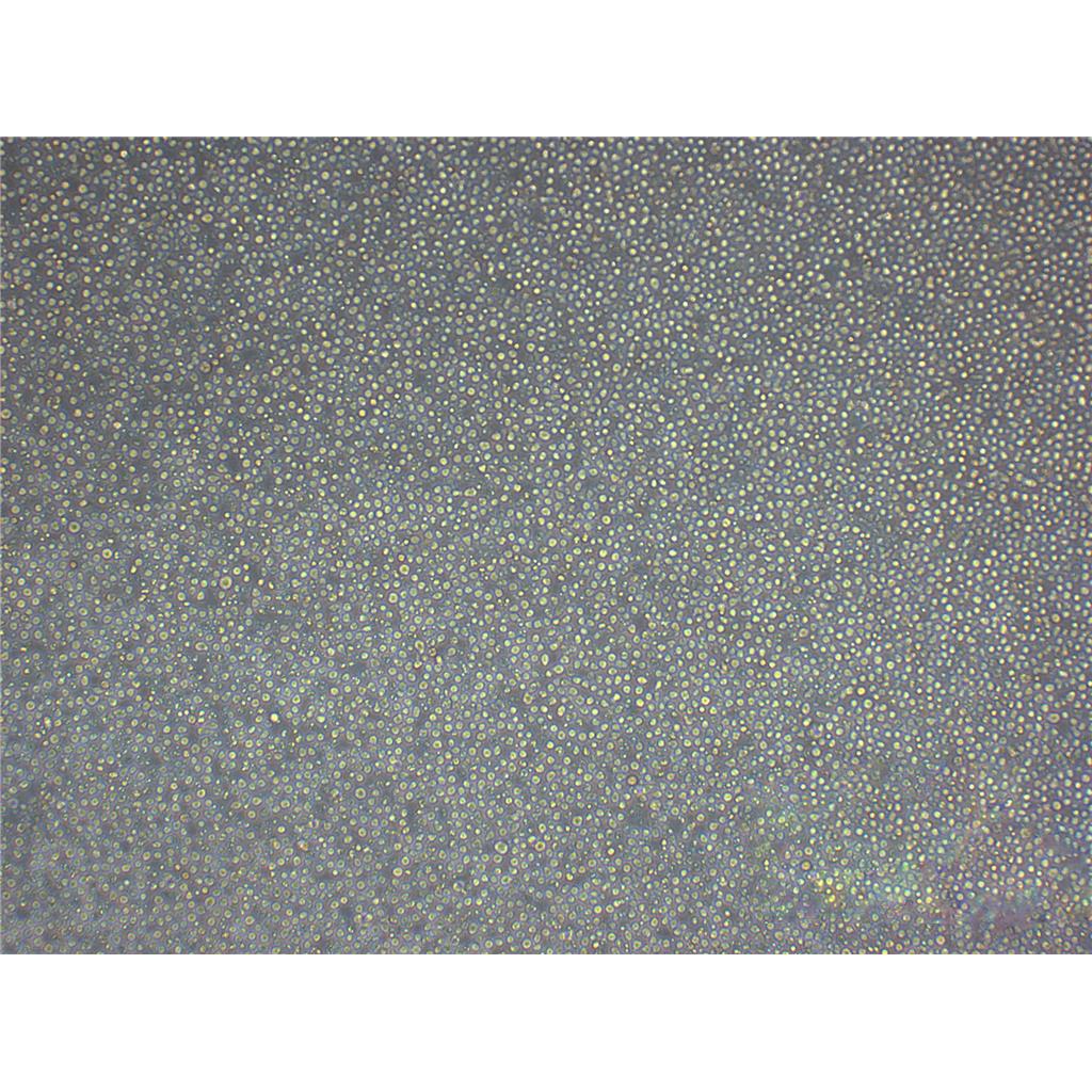 MARC-145[Marc-145; Marc 145; Marc145] Cells#非洲绿猴胚胎肾细胞系保种中心(通过STR鉴定)