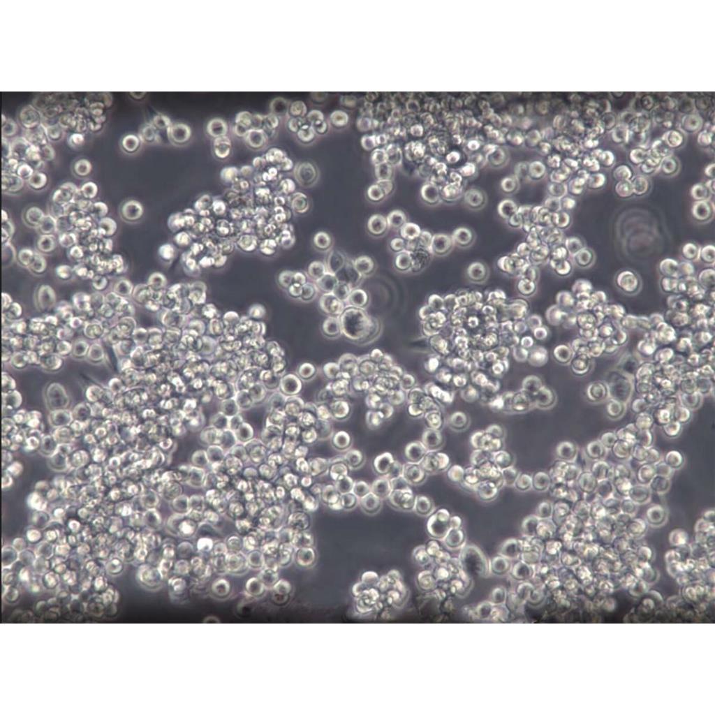 NCI-H1793 Cells:人肺癌细胞系代次低(带STR鉴定报告)