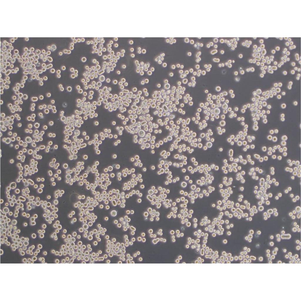 Caov-3 Cells:人乳突状卵巢腺癌细胞系代次低(带STR鉴定报告)