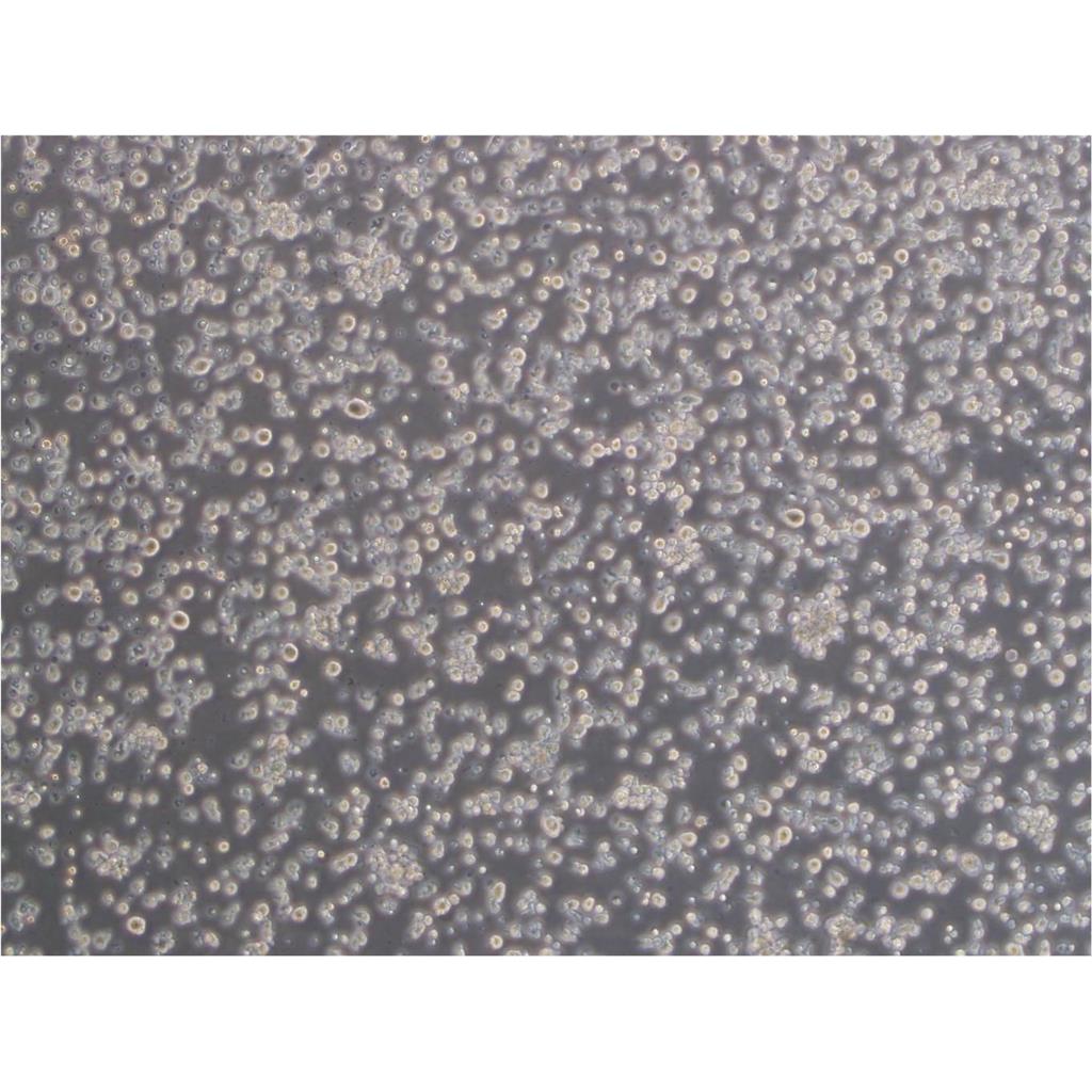 SUIT-2 Cells人胰腺癌细胞专业复苏|STR图谱