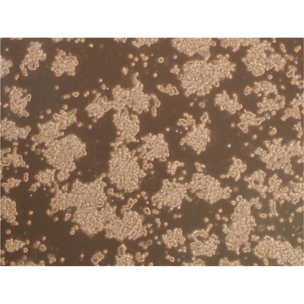 RPMI-8226 Cells人多发性骨髓瘤外周血B淋巴细胞专业复苏|STR图谱