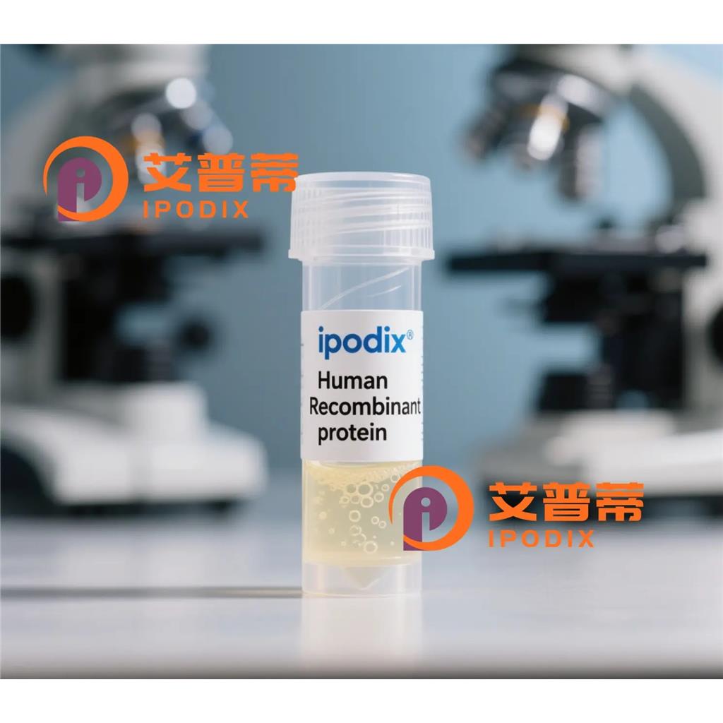 ANXA2抗体—艾普蒂