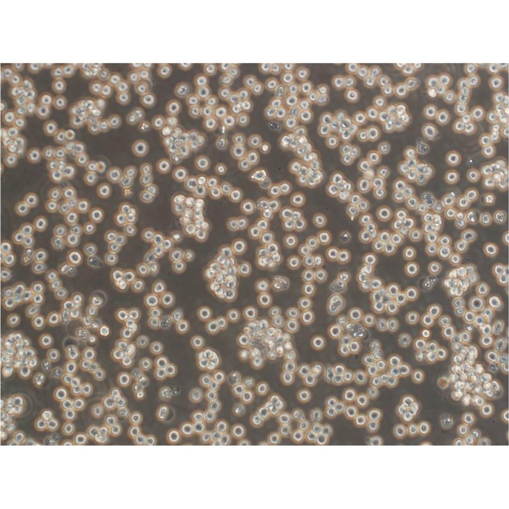 NCI-H295R Cells人肾上腺皮质腺癌细胞ATCC保种|STR图谱