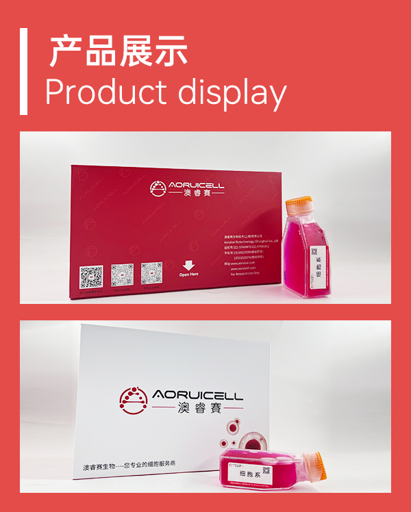 人副神经节瘤细胞永生化