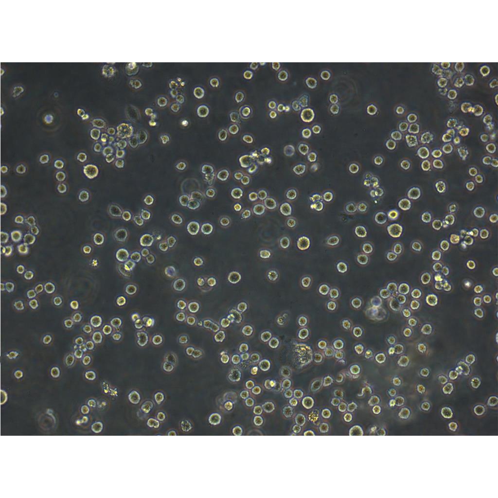NCI-H23 Cells人非小细胞肺癌细胞专业复苏|STR图谱