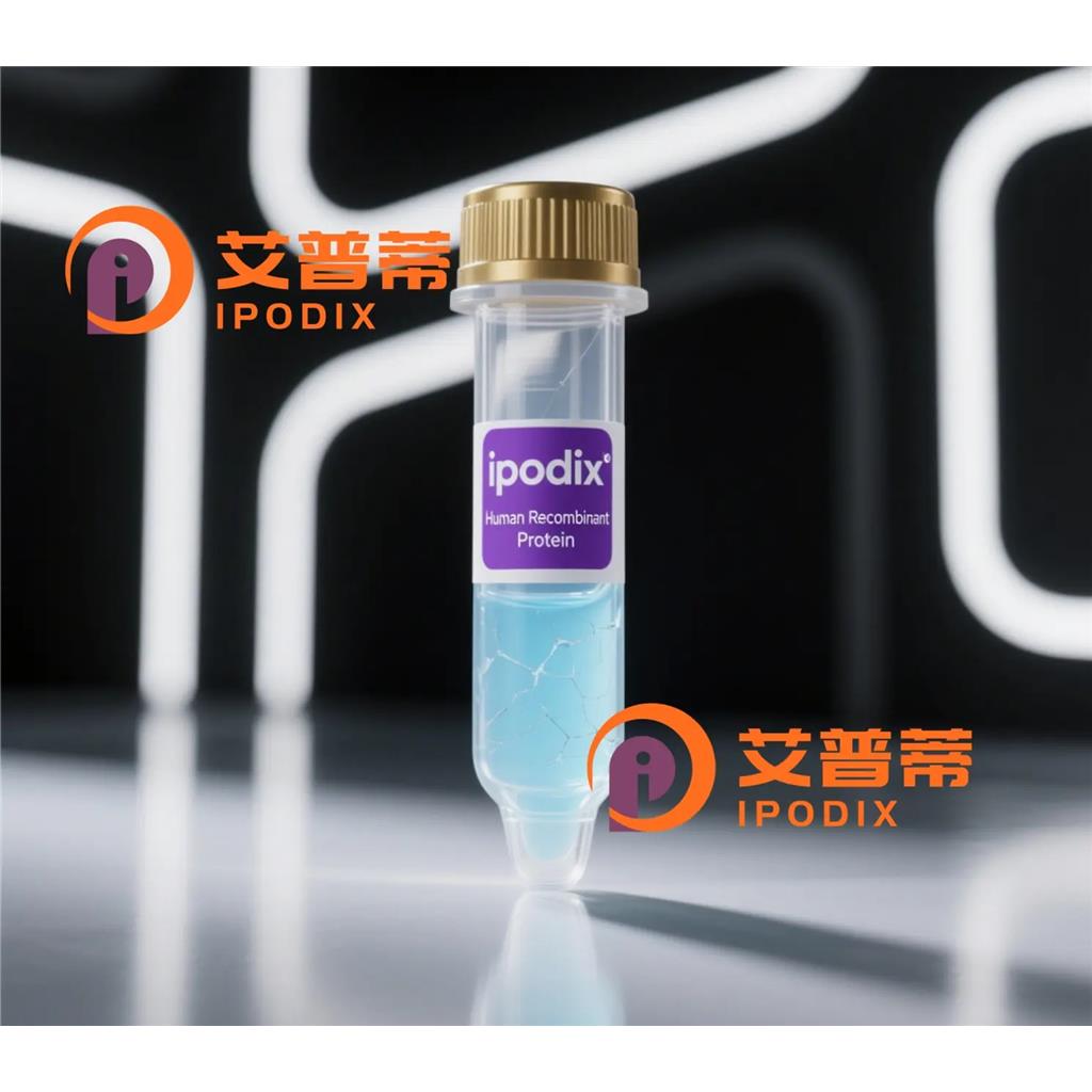 GPT抗体;GPT Antibody—艾普蒂