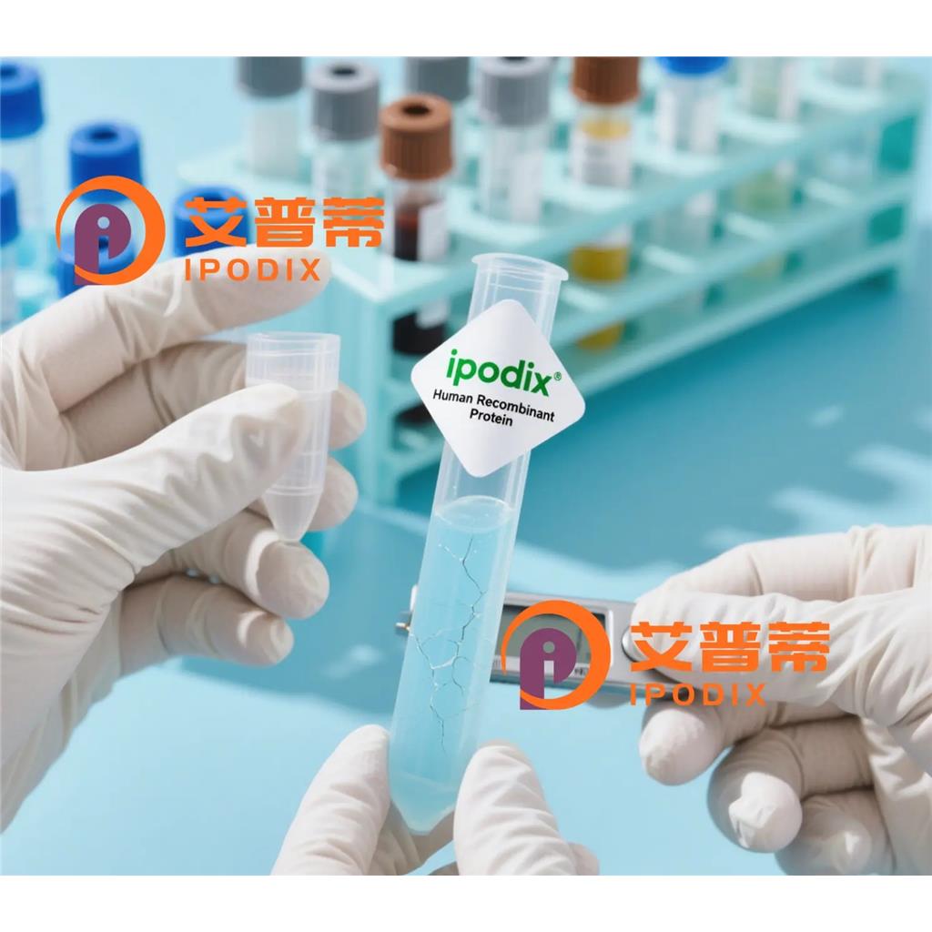 DEK抗体;DEK Antibody—艾普蒂