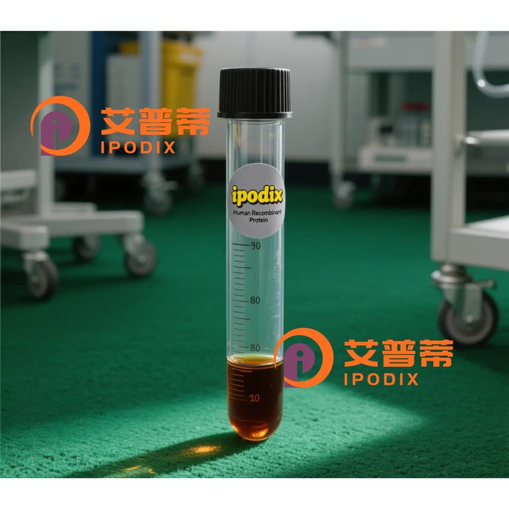 SGK1抗体;SGK1 Antibody—艾普蒂