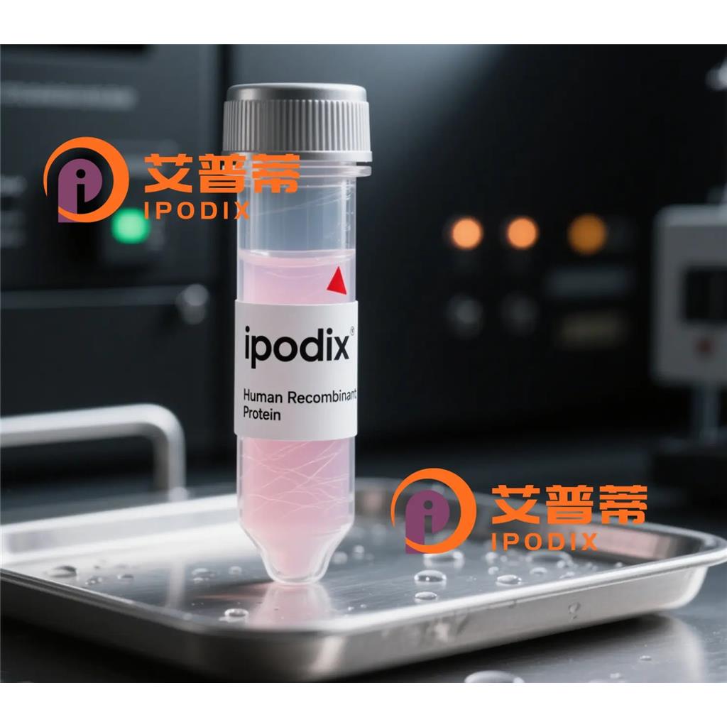 GARS抗体;GARS Antibody—艾普蒂