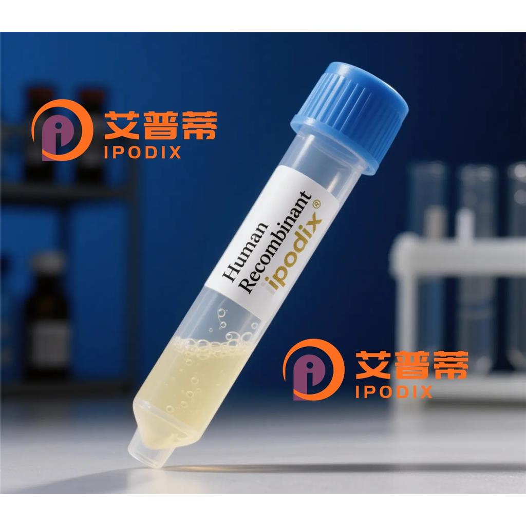 UBF1抗体;UBF1 Antibody—艾普蒂