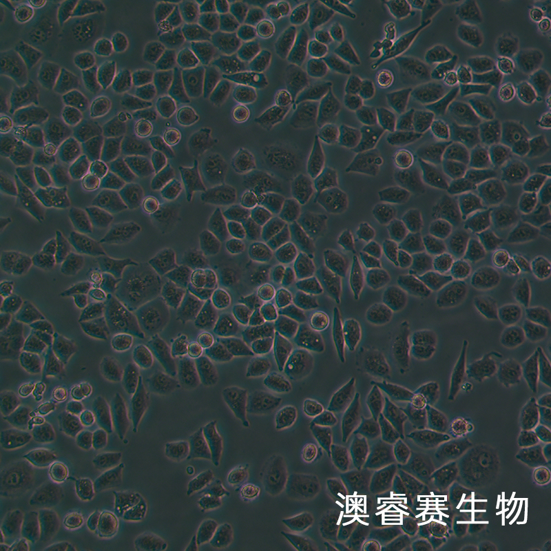 IOSE-80（人正常卵巢上皮细胞系）