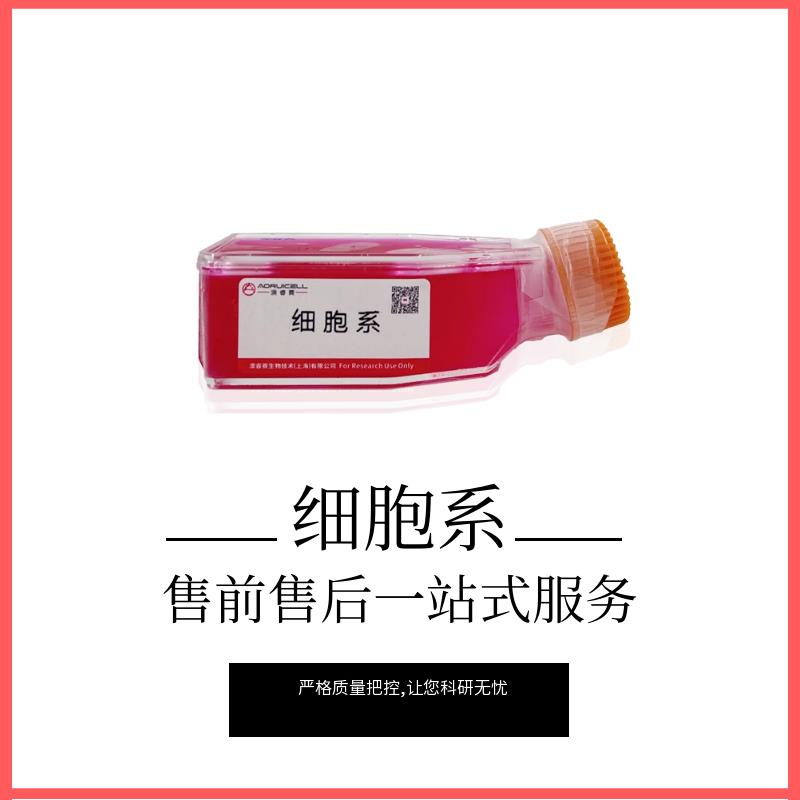 人淋巴管内皮细胞永生化