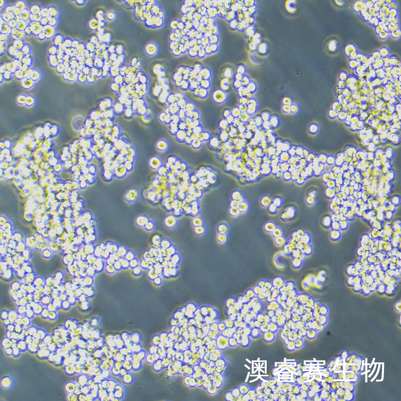 Walker/LLC-WRC 256（大鼠腹水癌细胞）