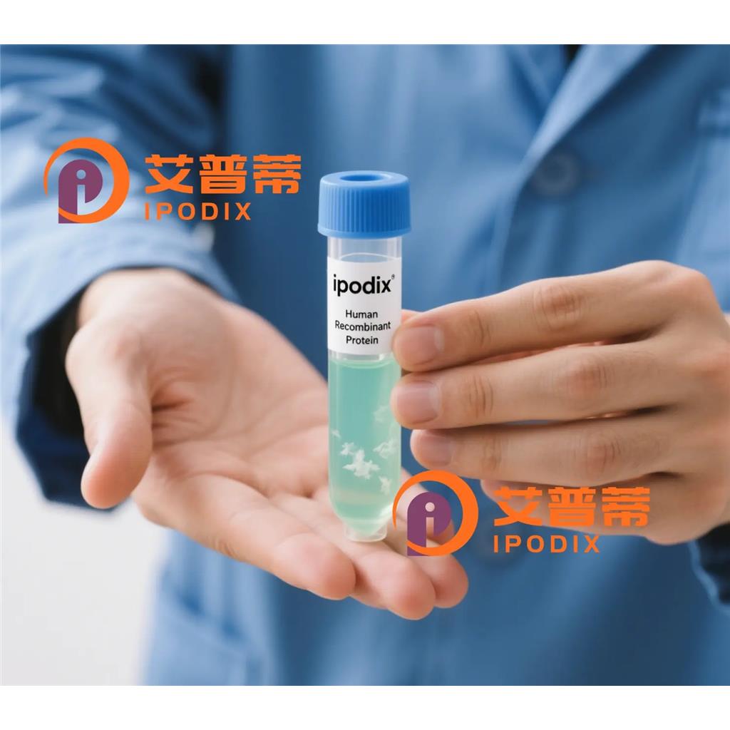 Ataxin 1抗体;Ataxin 1 Antibody—艾普蒂