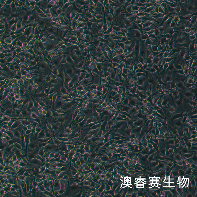 B16-F10（小鼠皮肤黑色素瘤细胞）