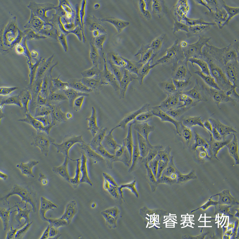 Vero（非洲绿猴肾细胞）