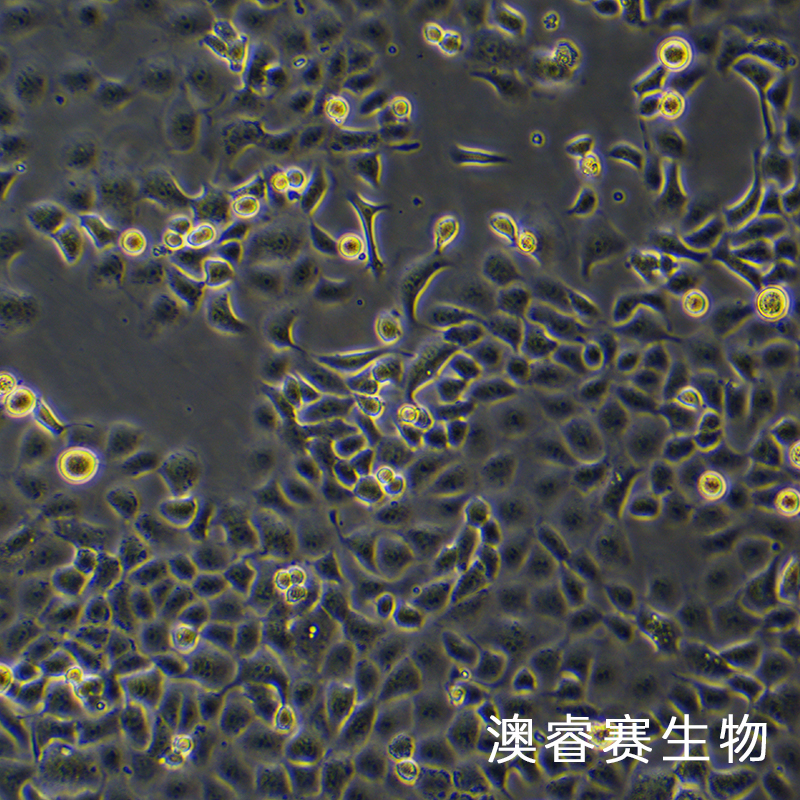 SHZ-88(大鼠乳腺癌细胞)
