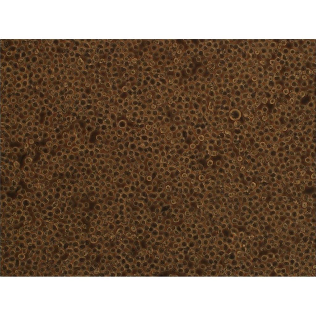 C918 Cells人眼脉络黑色素瘤细胞种子库代次低