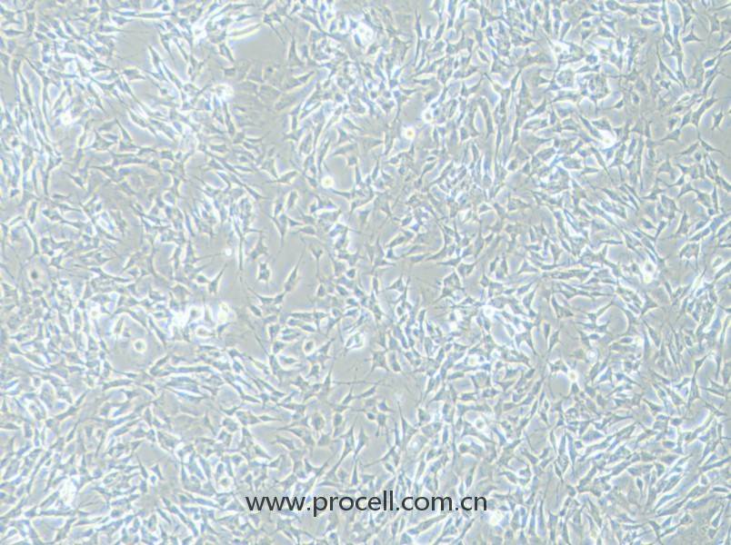 SH-SY5Y 细胞[SHSY-5Y细胞] (人神经母细胞瘤细胞) (STR鉴定正确)CL-0208