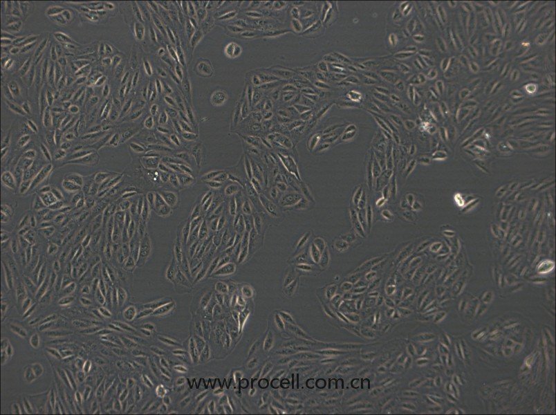 ARPE-19细胞 (人视网膜上皮细胞) (STR鉴定正确)CL-0026