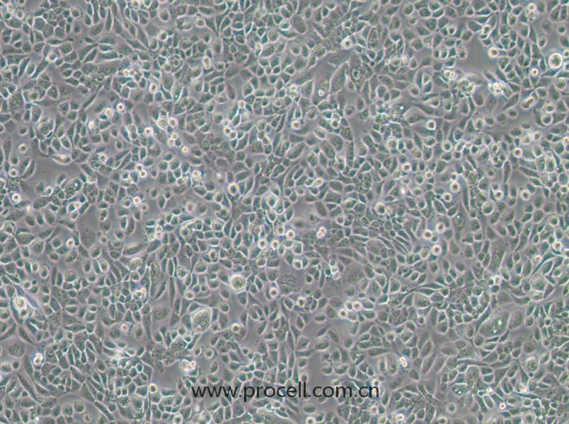 VK2/E6E7（人阴道上皮细胞）（STR鉴定正确）CL-1024