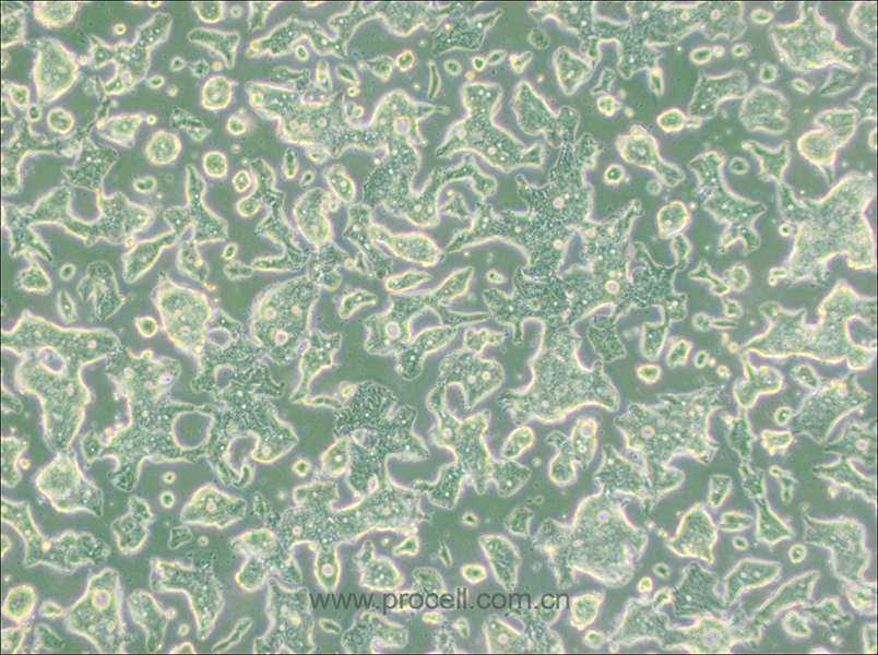 SW948细胞 (人结肠腺癌细胞) (STR鉴定正确)CL-0629