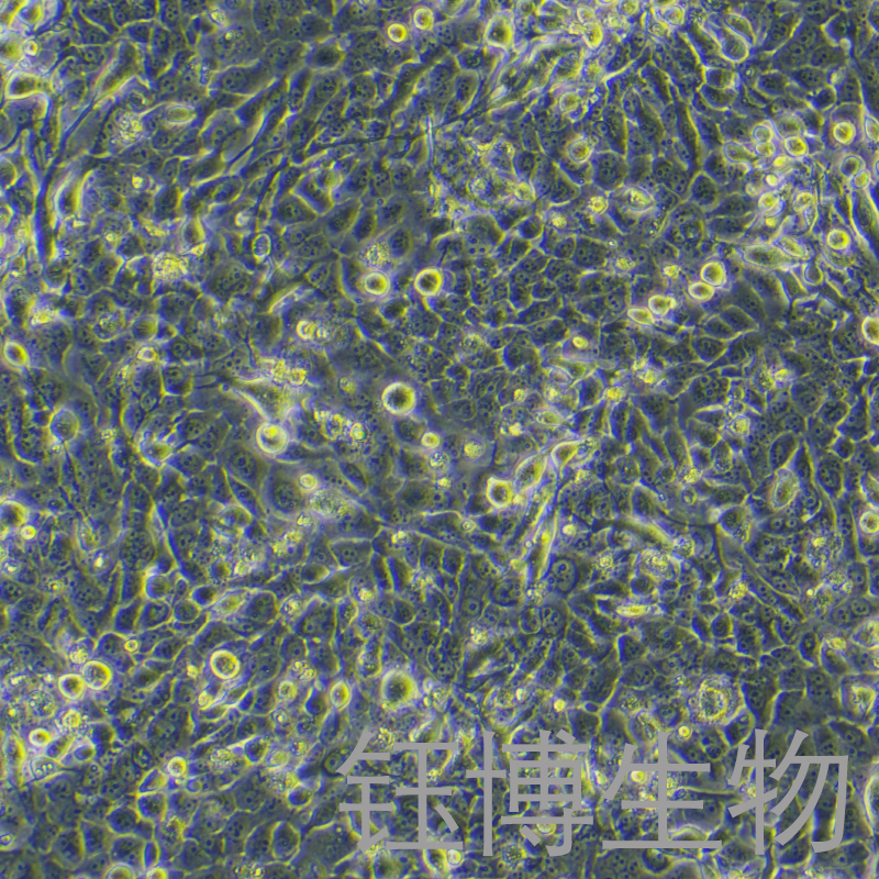TE-11（人食管癌细胞）YB-71454HC