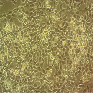 HEC-6人子宫内膜腺癌细胞
