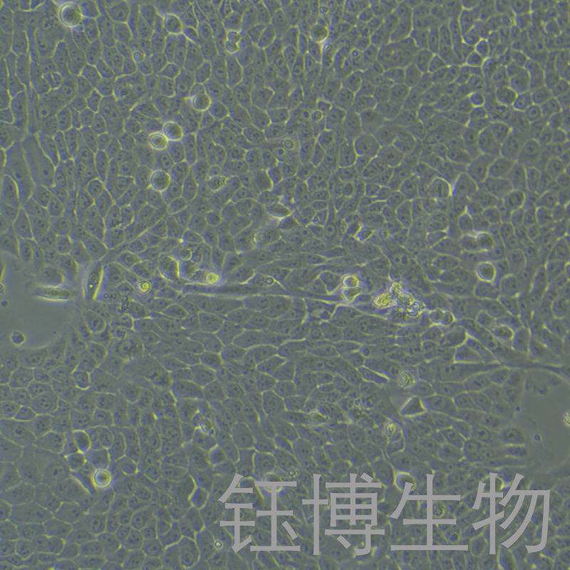MCF 10A（人正常乳腺上皮细胞）YB-71525HC