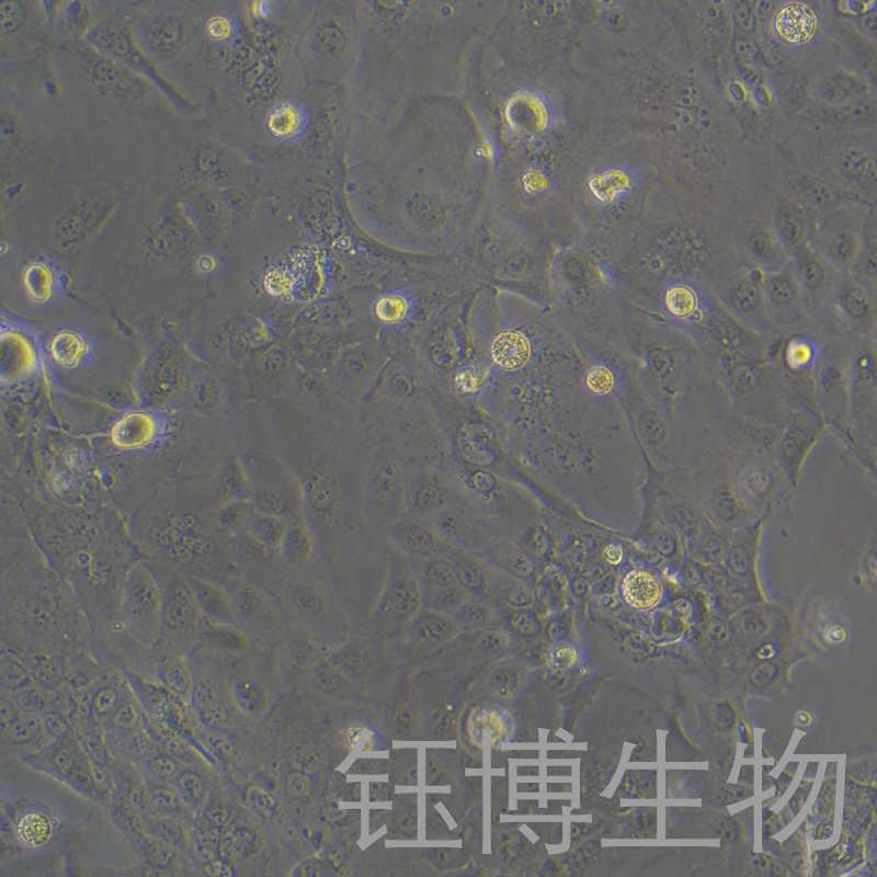 HPAF-II（人胰腺癌细胞）YB-71611HC