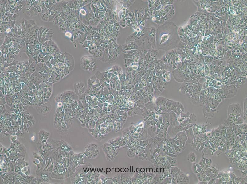 MDA-MB-415细胞 (人乳腺癌细胞) (STR鉴定正确)CL-0382