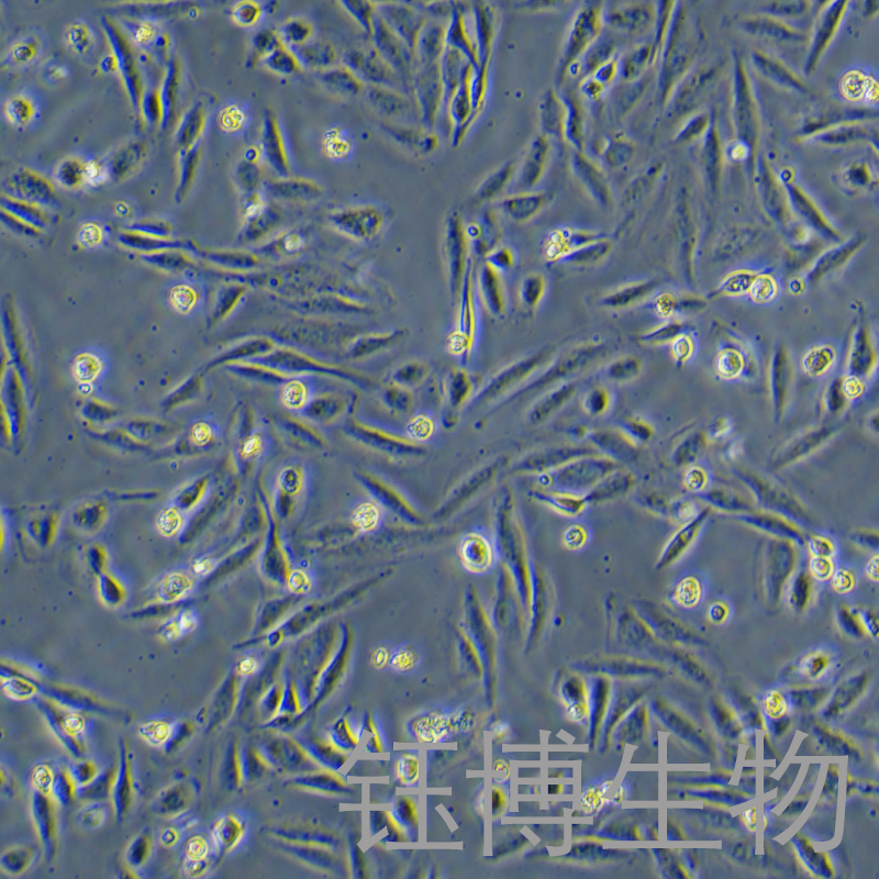 KTC-1（人甲状腺癌细胞）YB-71649HC