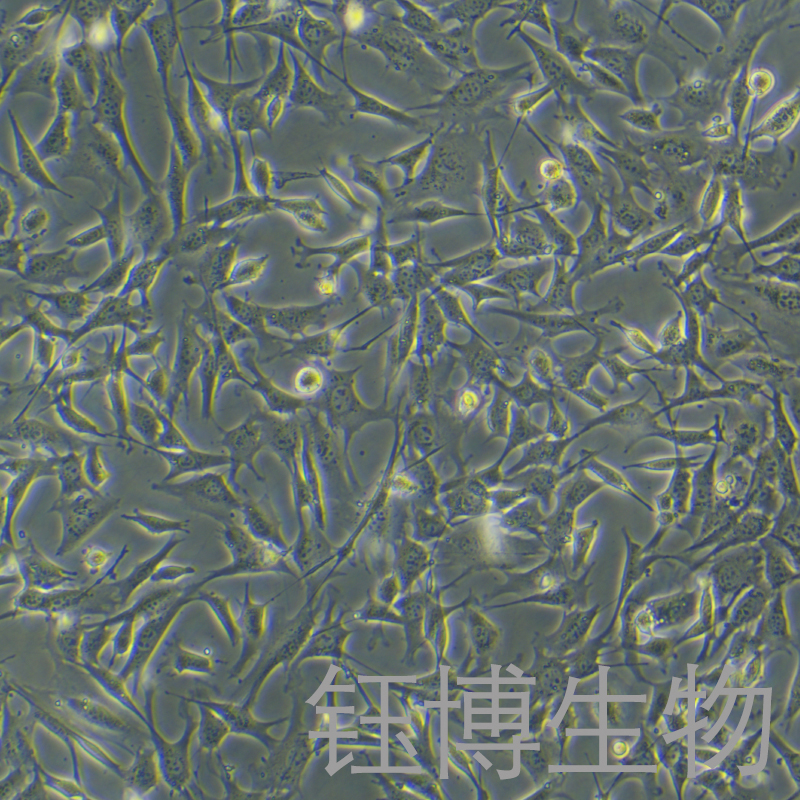 C127 [C-127]（小鼠乳腺肿瘤细胞）YB-72043MC