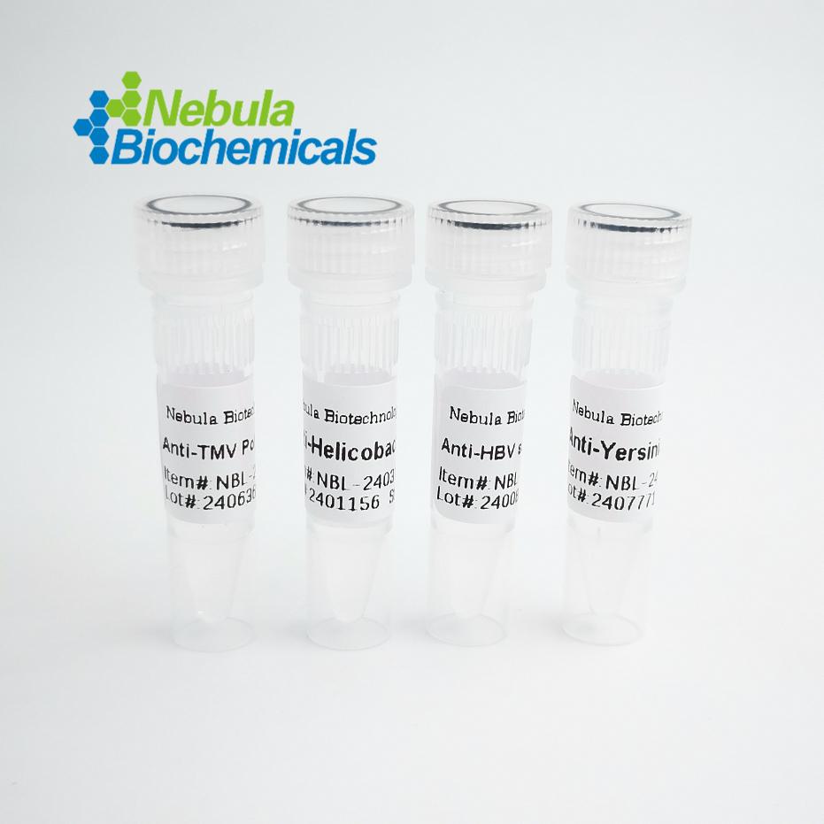 抗基孔肯雅病毒E2（CHIKV）多克隆抗体|Chikungunya Virus E2 Polyclonal Antibody|NBAB-160097