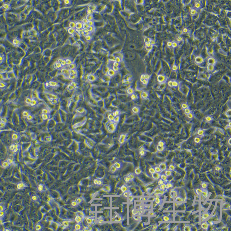 SK-Hep-1（人肝癌细胞）YB-71212HC