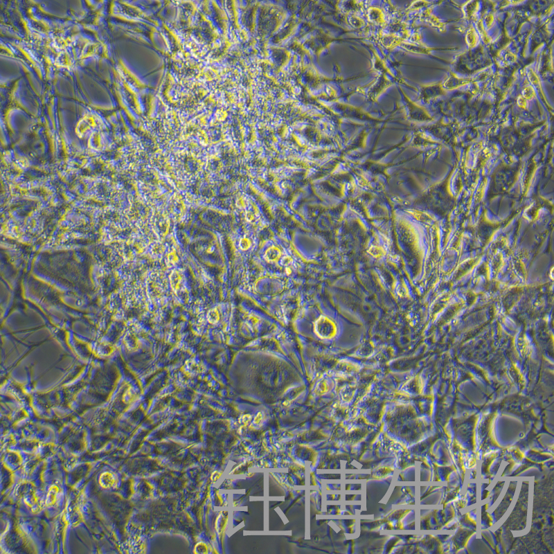 OP9（小鼠骨髓基质细胞）YB-72176MC