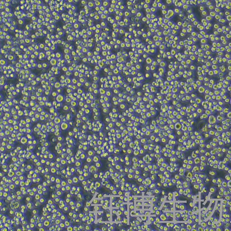 H22（小鼠肝癌细胞）YB-72341MC