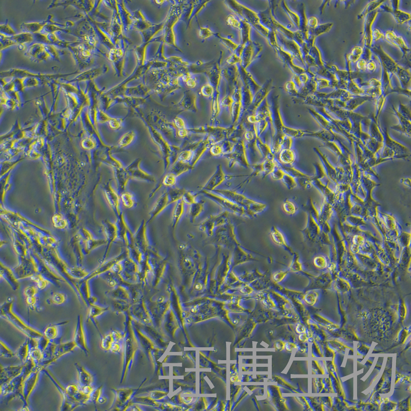 TM4（正常小鼠睾丸Sertoli细胞）YB-72456MC