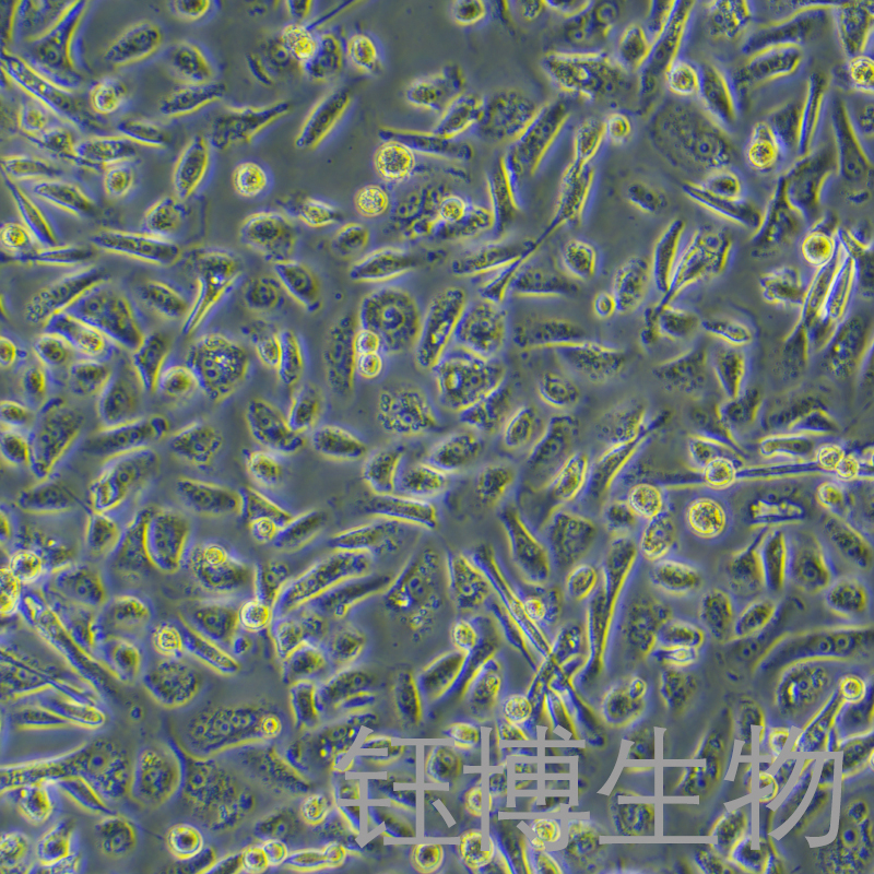 PC-3-LUC（人前列腺癌细胞荧光素酶标记）YB-71185HC-L