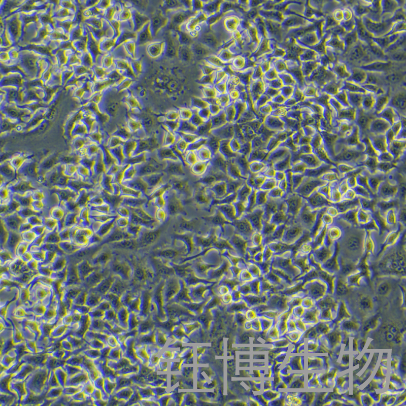 U373（人脑胶质瘤细胞）YB-71740HC