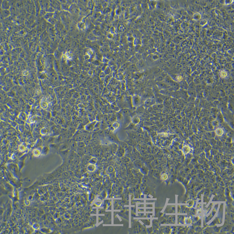 TU212（人喉癌细胞）YB-71742HC