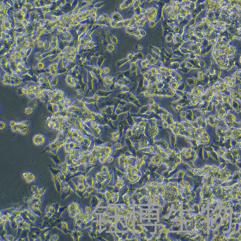 C666-1（人鼻咽癌细胞）YB-71757HC