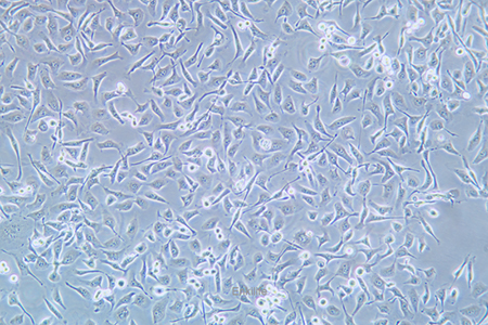 人鼻咽癌细胞HNE1(STR鉴定) | EnkiLife恩玑生命