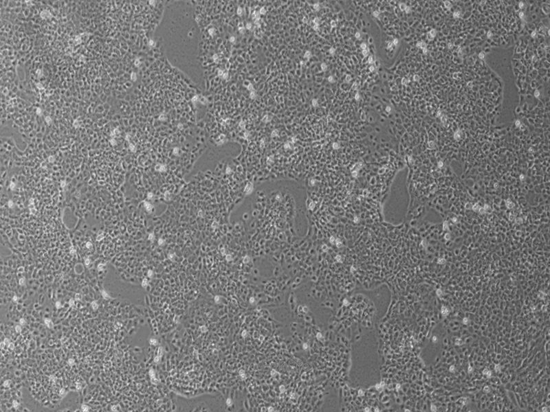 人大肠癌细胞CX-1(STR鉴定) | EnkiLife恩玑生命