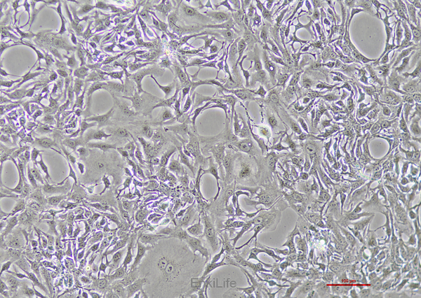 人胆管细胞型肝癌细胞Hccc9810(STR鉴定) | EnkiLife恩玑生命