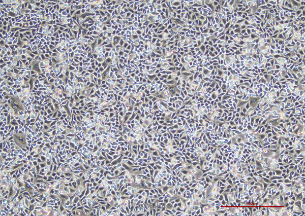 人非小细胞肺癌细胞 A549(STR鉴定) | EnkiLife恩玑生命