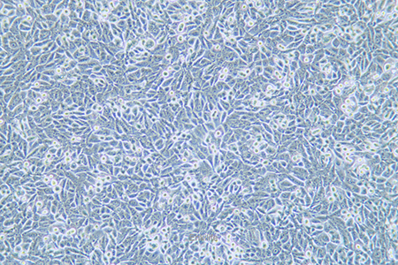 人非小细胞肺癌细胞NCI-H358(STR鉴定) | EnkiLife恩玑生命
