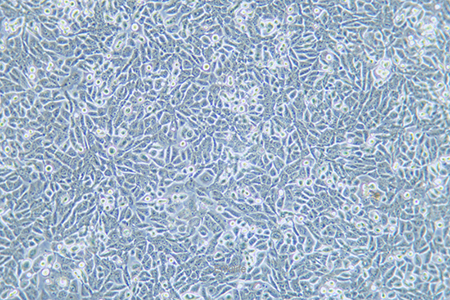人非小细胞肺癌细胞NCI-H358(STR鉴定) | EnkiLife恩玑生命